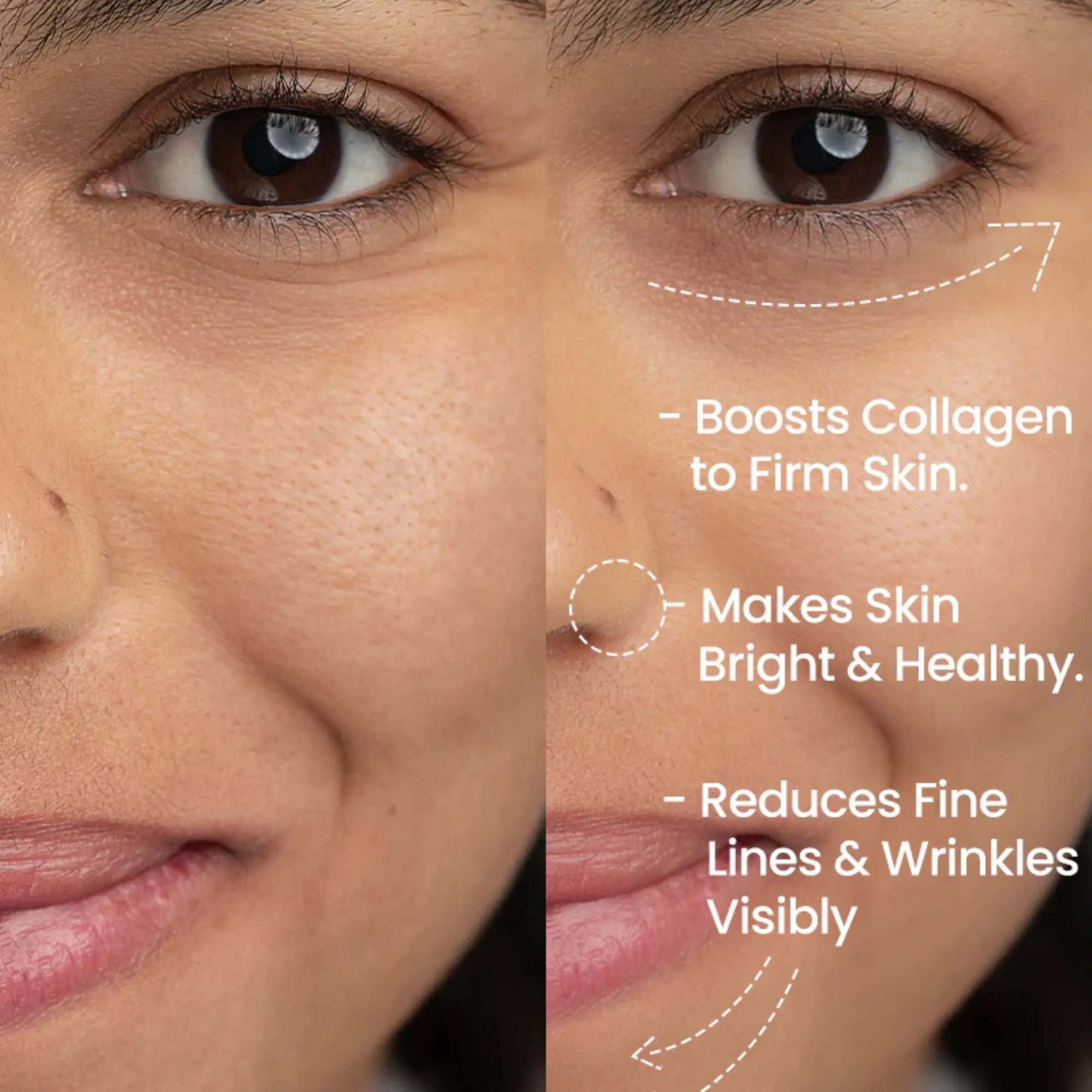 Retinal Liposome Cream - Erase dark circles, fine lines, and wrinkles