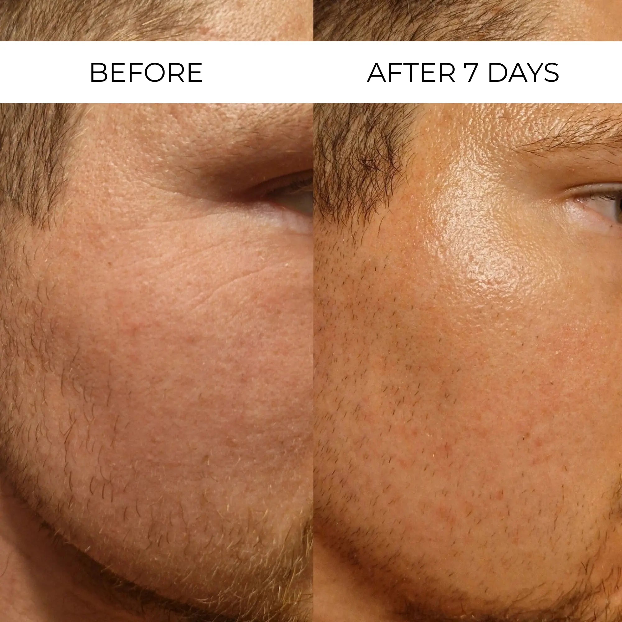 Retinal Liposome Cream - Erase dark circles, fine lines, and wrinkles