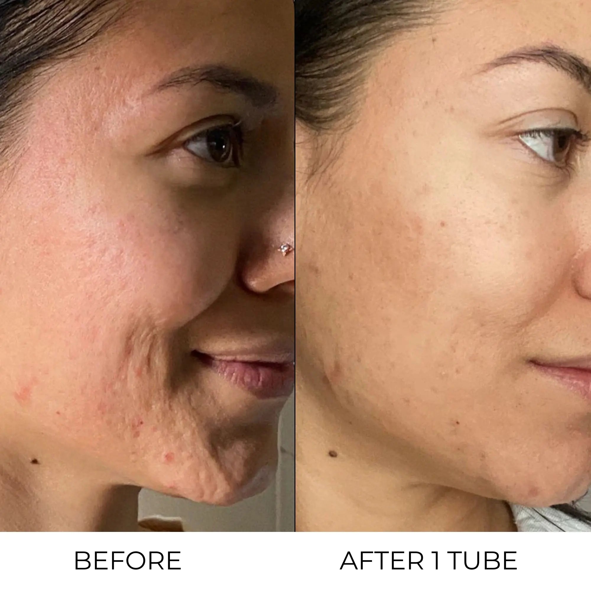 Retinal Liposome Cream - Erase dark circles, fine lines, and wrinkles