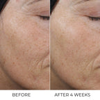 Retinal Liposome Cream - Erase dark circles, fine lines, and wrinkles