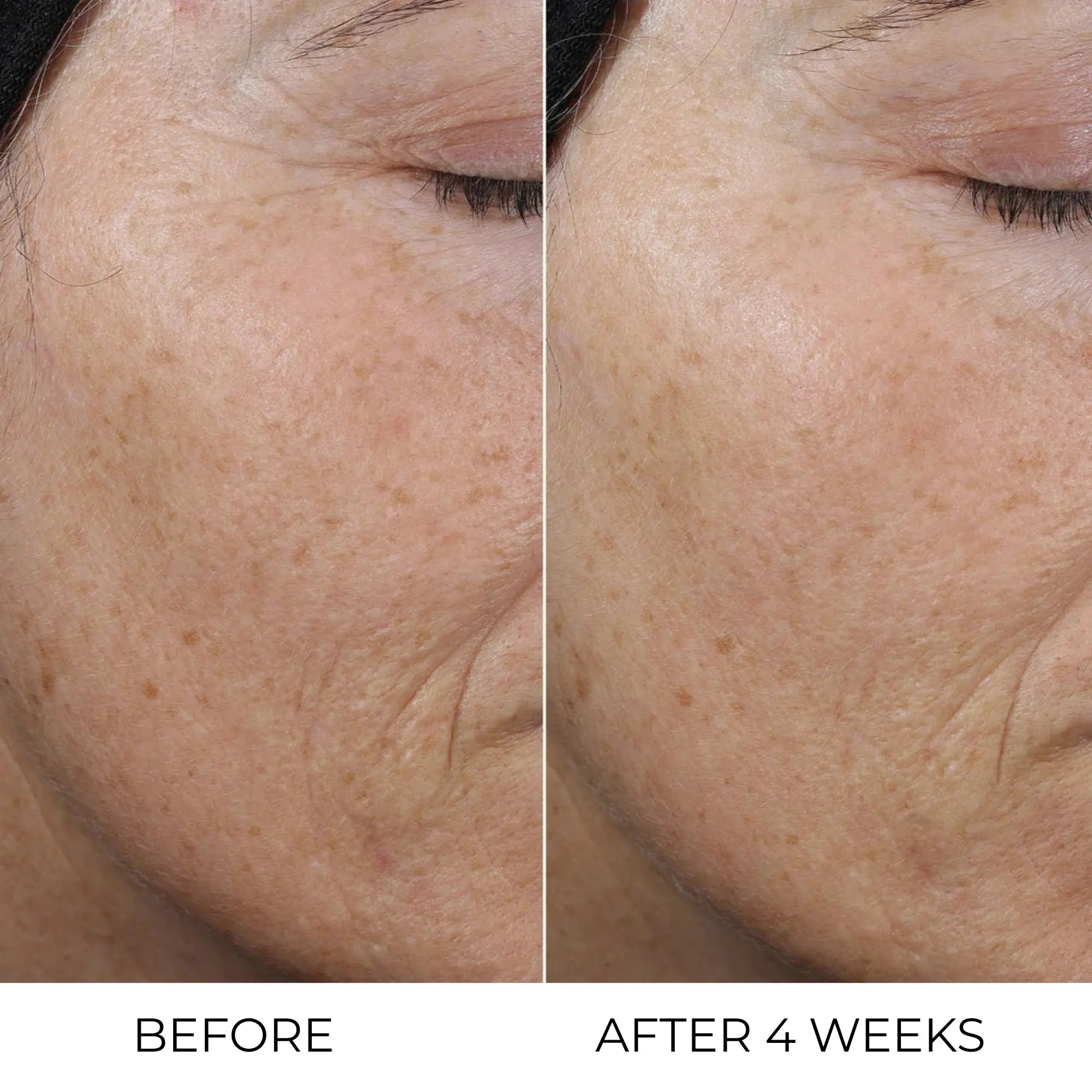 Retinal Liposome Cream - Erase dark circles, fine lines, and wrinkles