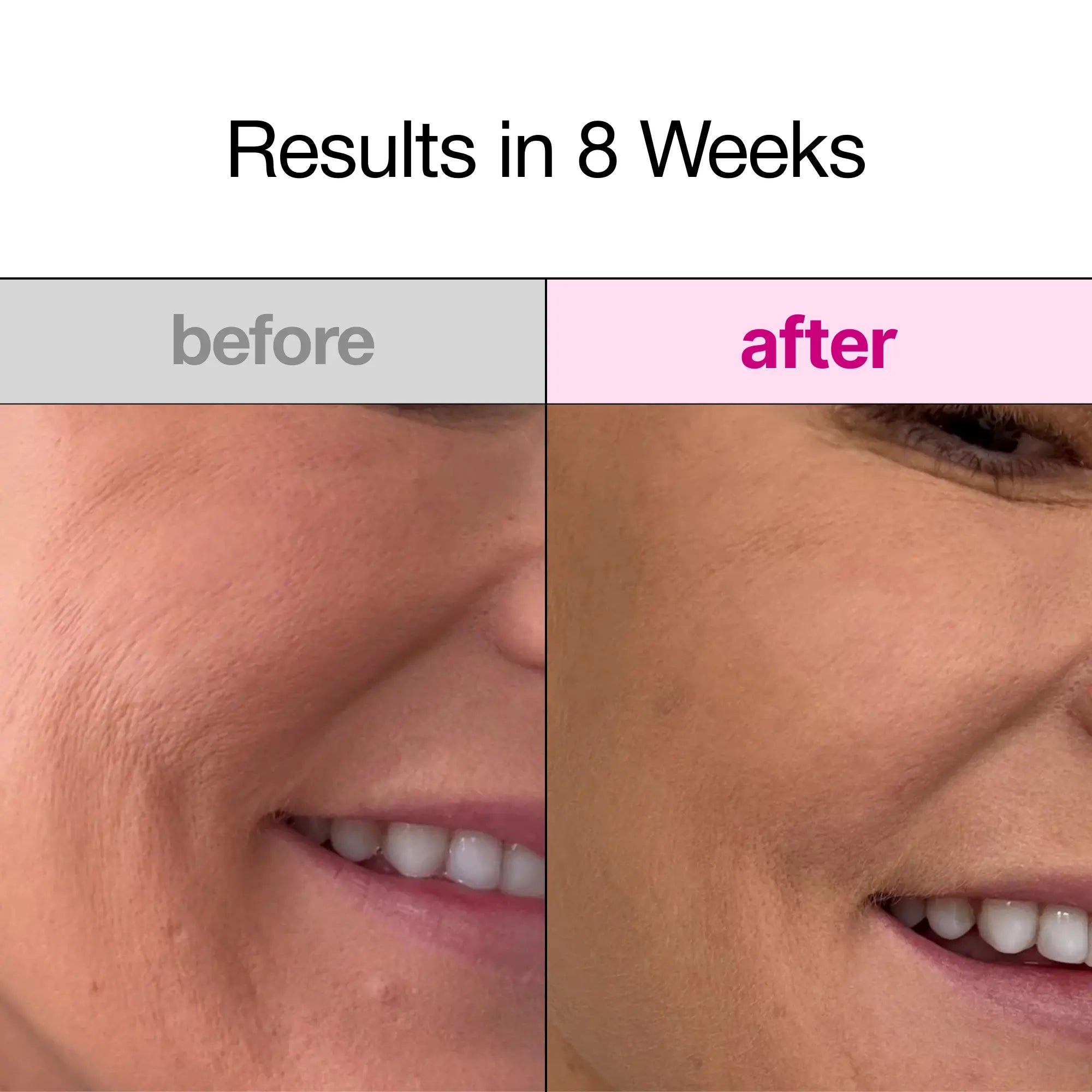 Overnight Collagen Face Mask