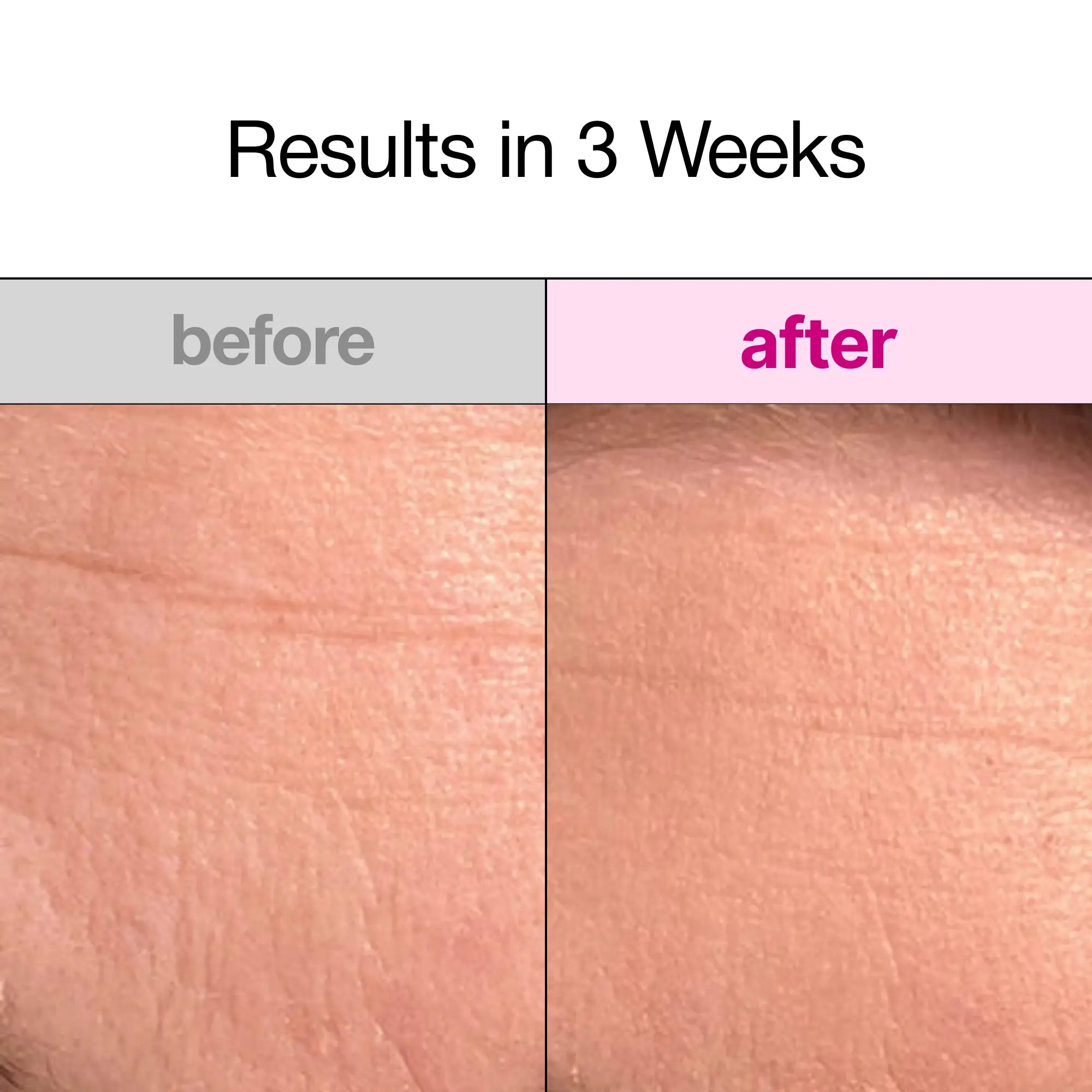 Overnight Collagen Face Mask