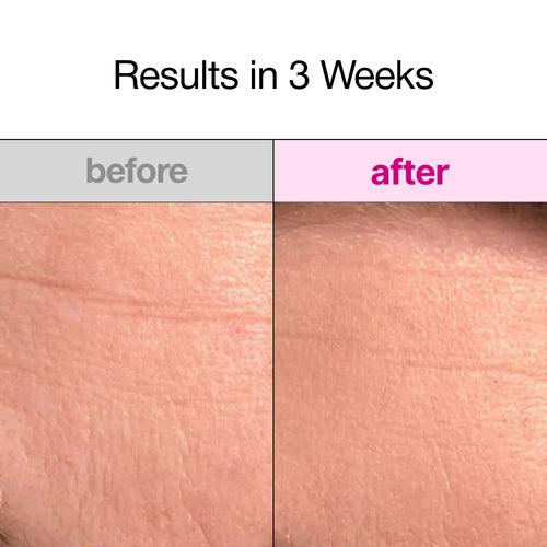 Overnight Collagen Face Mask